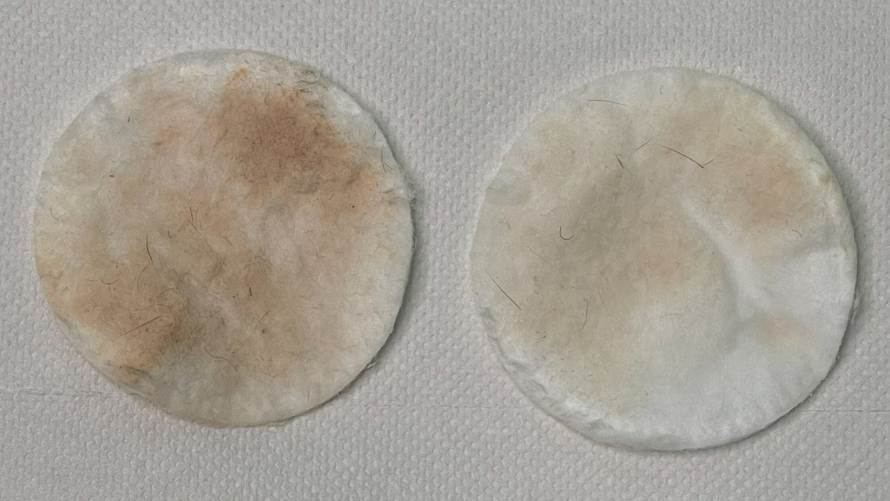 Cotton pads after cleansing with glyco-active soap during a facial at BeCammo, Malta